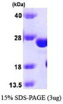 SDS-PAGE: Recombinant Human Glutathione S Transferase kappa 1 Protein [NBP1-37083]