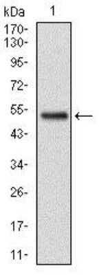 Western Blot: Glutathione S-Transferase mu 1/GSTM1 Antibody (1H4F2)BSA Free [NBP2-22186]
