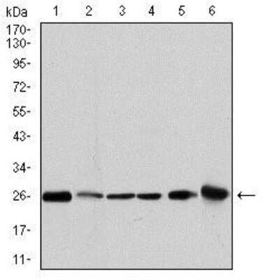 Western Blot: Glutathione S-Transferase mu 1/GSTM1 Antibody (1H4F2)BSA Free [NBP2-22186]