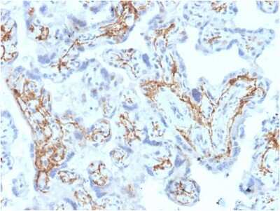 Immunohistochemistry-Paraffin: Glutathione S-Transferase mu 1/GSTM1 Antibody (CPTC-GSTMu1-3) - Azide and BSA Free [NBP3-08254]