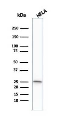 Western Blot: Glutathione S-Transferase mu 1/GSTM1 Antibody (CPTC-GSTMu1-3) [NBP3-07345]