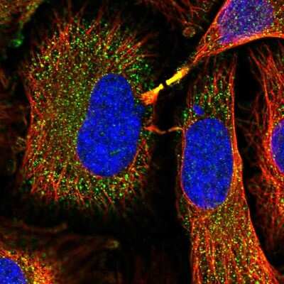 Immunocytochemistry/ Immunofluorescence: Glutathione S-Transferase mu 1/GSTM1 Antibody [NBP2-46827]