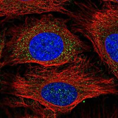 Immunocytochemistry/ Immunofluorescence: Glutathione S-Transferase mu 1/GSTM1 Antibody [NBP2-46828]