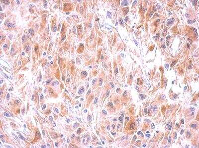 Immunohistochemistry-Paraffin: Glutathione S-Transferase mu 1/GSTM1 Antibody [NBP1-30876]