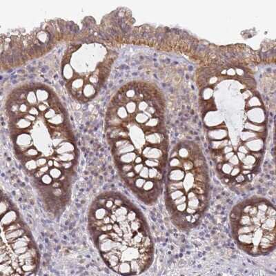 Immunohistochemistry-Paraffin: Glutathione S-Transferase mu 1/GSTM1 Antibody [NBP2-46828]
