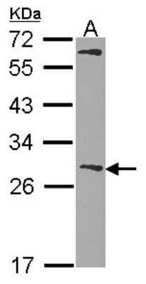 Western Blot: Glutathione S-Transferase mu 1/GSTM1 Antibody [NBP1-30876]