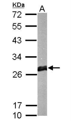 Western Blot: Glutathione S-Transferase mu 1/GSTM1 Antibody [NBP1-33523]