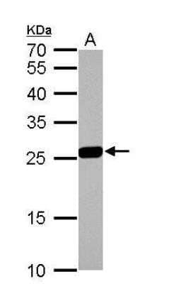 Western Blot: Glutathione S-Transferase mu 1/GSTM1 Antibody [NBP1-33523]