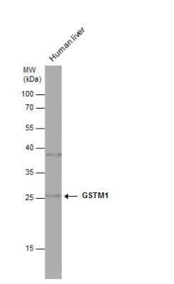 Western Blot: Glutathione S-Transferase mu 1/GSTM1 Antibody [NBP1-33523]