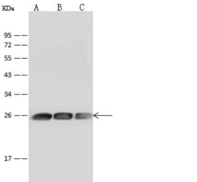 Western Blot: Glutathione S-Transferase pi 1/GSTP1 Antibody (003) [NBP2-89323]