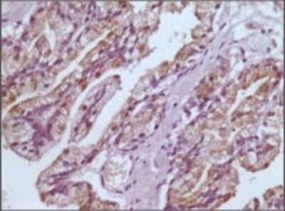 Immunohistochemistry-Paraffin: Glutathione S-Transferase pi 1/GSTP1 Antibody (3F2C2) - BSA Free [NB110-60512]