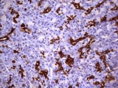 Immunohistochemistry: Glutathione S-Transferase pi 1/GSTP1 Antibody (OTI4B6) [NBP2-45916]