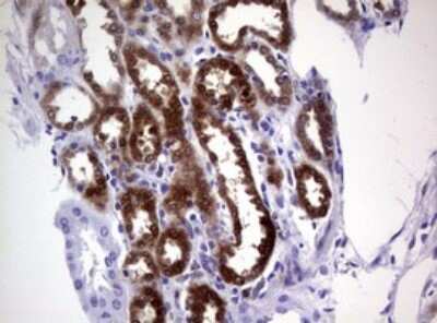 Immunohistochemistry: Glutathione S-Transferase pi 1/GSTP1 Antibody (OTI4B6) [NBP2-45916]