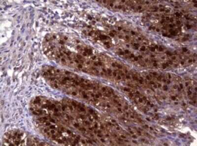 Immunohistochemistry: Glutathione S-Transferase pi 1/GSTP1 Antibody (OTI4B6) [NBP2-45916]