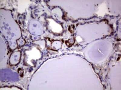 Immunohistochemistry: Glutathione S-Transferase pi 1/GSTP1 Antibody (OTI4B6) [NBP2-45916]