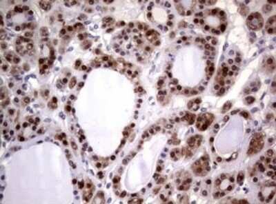 Immunohistochemistry: Glutathione S-Transferase pi 1/GSTP1 Antibody (OTI4B6) [NBP2-45916]