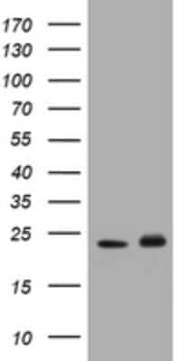 Western Blot: Glutathione S-Transferase pi 1/GSTP1 Antibody (OTI4B6) [NBP2-45916]