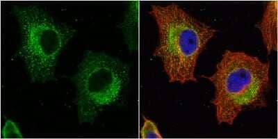 Immunocytochemistry/ Immunofluorescence: Glutathione S-Transferase pi 1/GSTP1 Antibody [NBP1-33627]