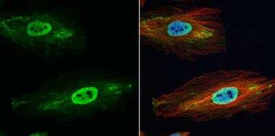 Immunocytochemistry/ Immunofluorescence: Glutathione S-Transferase pi 1/GSTP1 Antibody [NBP2-16756]