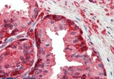 Immunohistochemistry-Paraffin: Glutathione S-Transferase pi 1/GSTP1 Antibody [NB100-1792]