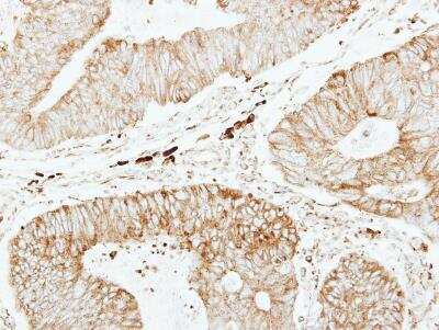 Immunohistochemistry-Paraffin: Glutathione S-Transferase pi 1/GSTP1 Antibody [NBP1-33627]