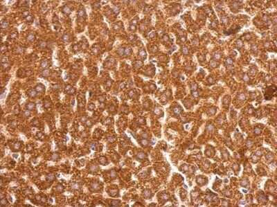 Immunohistochemistry-Paraffin: Glutathione S-Transferase pi 1/GSTP1 Antibody [NBP1-33627]
