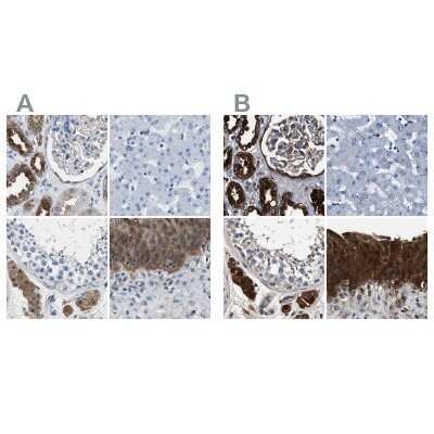 Immunohistochemistry-Paraffin: Glutathione S-Transferase pi 1/GSTP1 Antibody [NBP1-84747]
