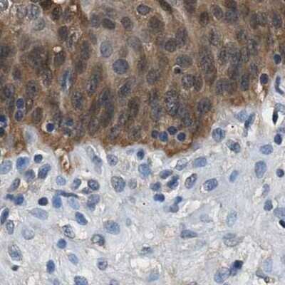 Immunohistochemistry-Paraffin: Glutathione S-Transferase pi 1/GSTP1 Antibody [NBP1-84747]