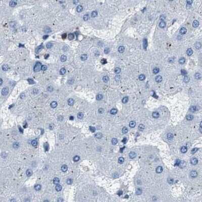 Immunohistochemistry-Paraffin: Glutathione S-Transferase pi 1/GSTP1 Antibody [NBP1-84747]