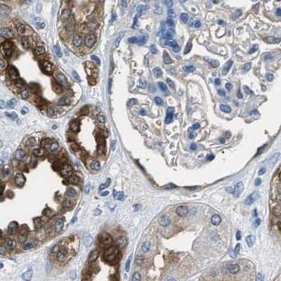Immunohistochemistry-Paraffin: Glutathione S-Transferase pi 1/GSTP1 Antibody [NBP1-84747]