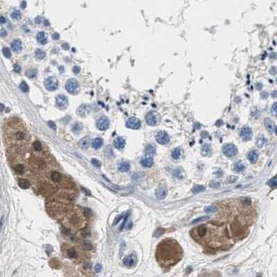Immunohistochemistry-Paraffin: Glutathione S-Transferase pi 1/GSTP1 Antibody [NBP1-84747]