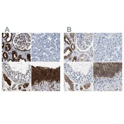 Immunohistochemistry-Paraffin: Glutathione S-Transferase pi 1/GSTP1 Antibody [NBP1-84748]