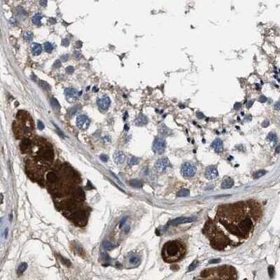 Immunohistochemistry-Paraffin: Glutathione S-Transferase pi 1/GSTP1 Antibody [NBP1-84748]