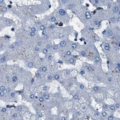 Immunohistochemistry-Paraffin: Glutathione S-Transferase pi 1/GSTP1 Antibody [NBP1-84748]
