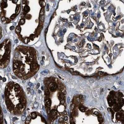 Immunohistochemistry-Paraffin: Glutathione S-Transferase pi 1/GSTP1 Antibody [NBP1-84748]