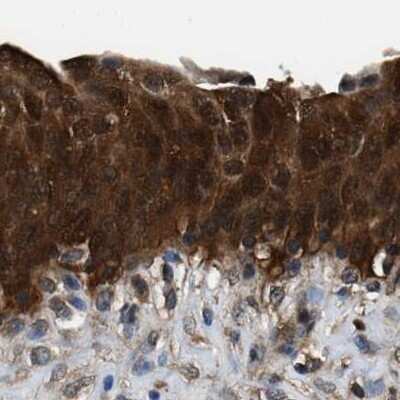 Immunohistochemistry-Paraffin: Glutathione S-Transferase pi 1/GSTP1 Antibody [NBP1-84748]