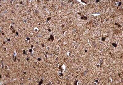 Immunohistochemistry-Paraffin: Glutathione S-Transferase pi 1/GSTP1 Antibody [NBP2-16756]