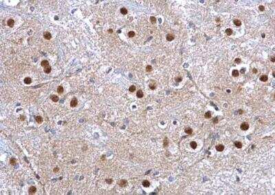 Immunohistochemistry-Paraffin: Glutathione S-Transferase pi 1/GSTP1 Antibody [NBP2-16756]