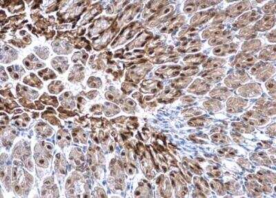 Immunohistochemistry-Paraffin: Glutathione S-Transferase pi 1/GSTP1 Antibody [NBP2-16756]