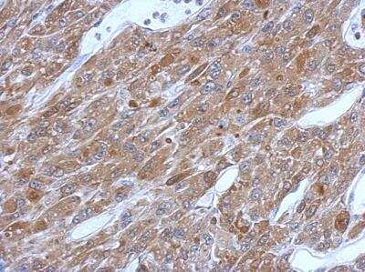 Immunohistochemistry-Paraffin: Glutathione S-Transferase pi 1/GSTP1 Antibody [NBP2-16756]