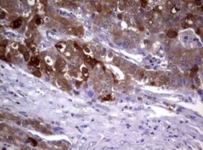 Immunohistochemistry: Glutathione S-Transferase pi 1/GSTP1 Antibody (OTI4B6) - Azide and BSA Free [NBP2-70857]