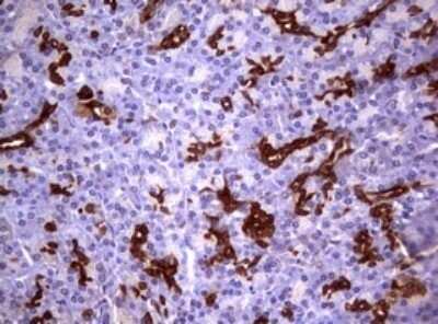 Immunohistochemistry: Glutathione S-Transferase pi 1/GSTP1 Antibody (OTI4B6) - Azide and BSA Free [NBP2-70857]