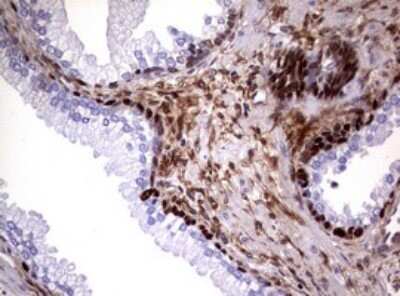 Immunohistochemistry: Glutathione S-Transferase pi 1/GSTP1 Antibody (OTI4B6) - Azide and BSA Free [NBP2-70857]