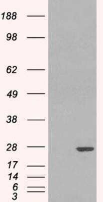 Western Blot: Glutathione S-Transferase pi 1/GSTP1 Antibody [NB100-1792]