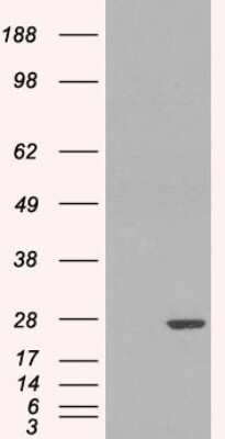 Western Blot: Glutathione S-Transferase pi 1/GSTP1 Antibody [NB100-1792]