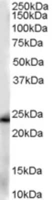 Western Blot: Glutathione S-Transferase pi 1/GSTP1 Antibody [NB100-1792]