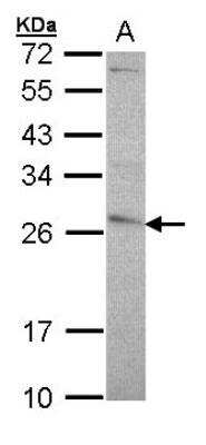 Western Blot: Glutathione S-Transferase pi 1/GSTP1 Antibody [NBP1-33627]