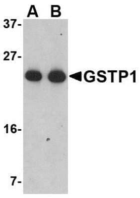 Western Blot: Glutathione S-Transferase pi 1/GSTP1 AntibodyBSA Free [NBP1-76857]