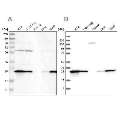 Western Blot: Glutathione S-Transferase pi 1/GSTP1 Antibody [NBP1-84747]