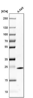 Western Blot: Glutathione S-Transferase pi 1/GSTP1 Antibody [NBP1-84748]